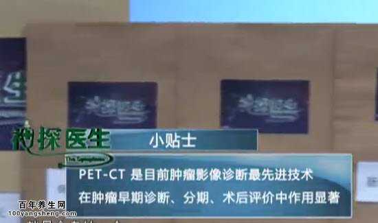 PET-CT